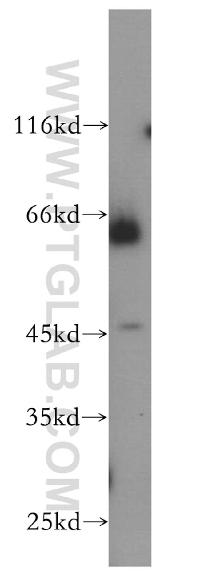 PIAS4 Antibody in Western Blot (WB)