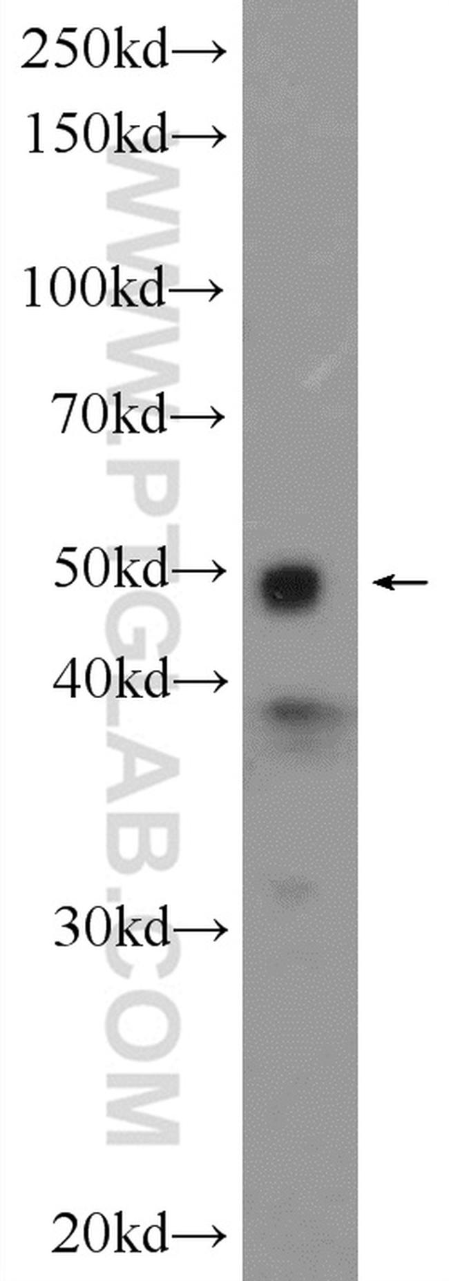 IKBKG Antibody in Western Blot (WB)