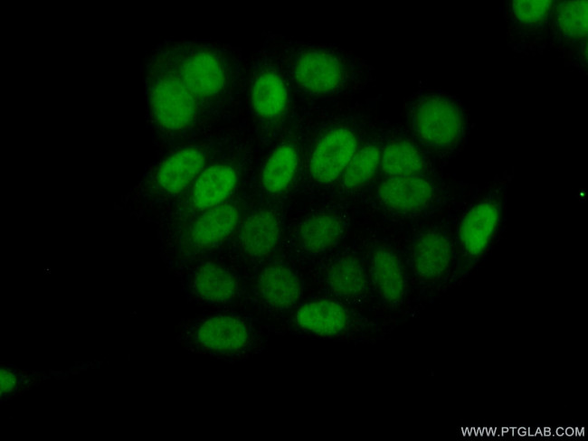 ID1 Antibody in Immunocytochemistry (ICC/IF)