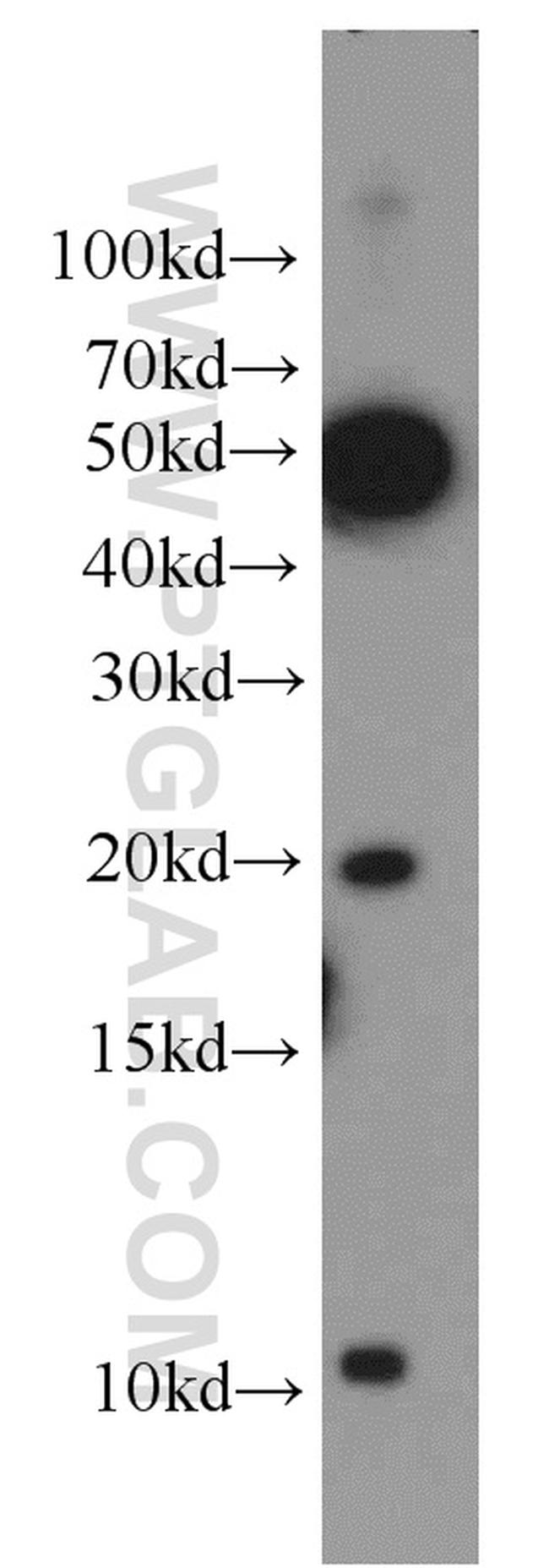 ID1 Antibody in Western Blot (WB)