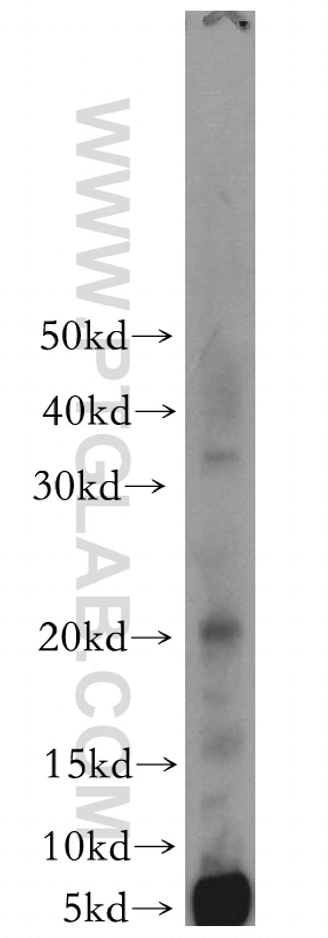 PPP1R14B Antibody in Western Blot (WB)