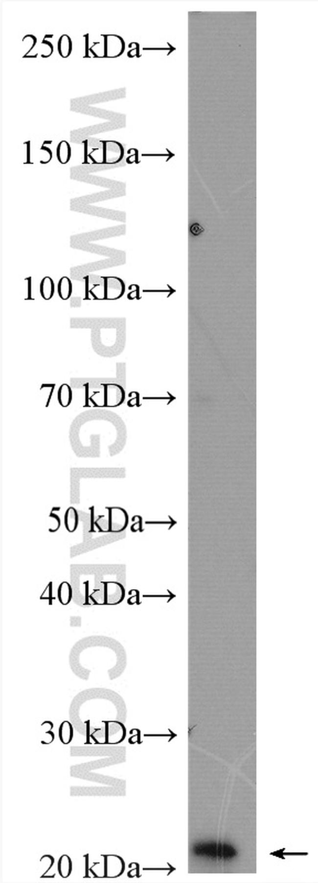 PPP1R14B Antibody in Western Blot (WB)