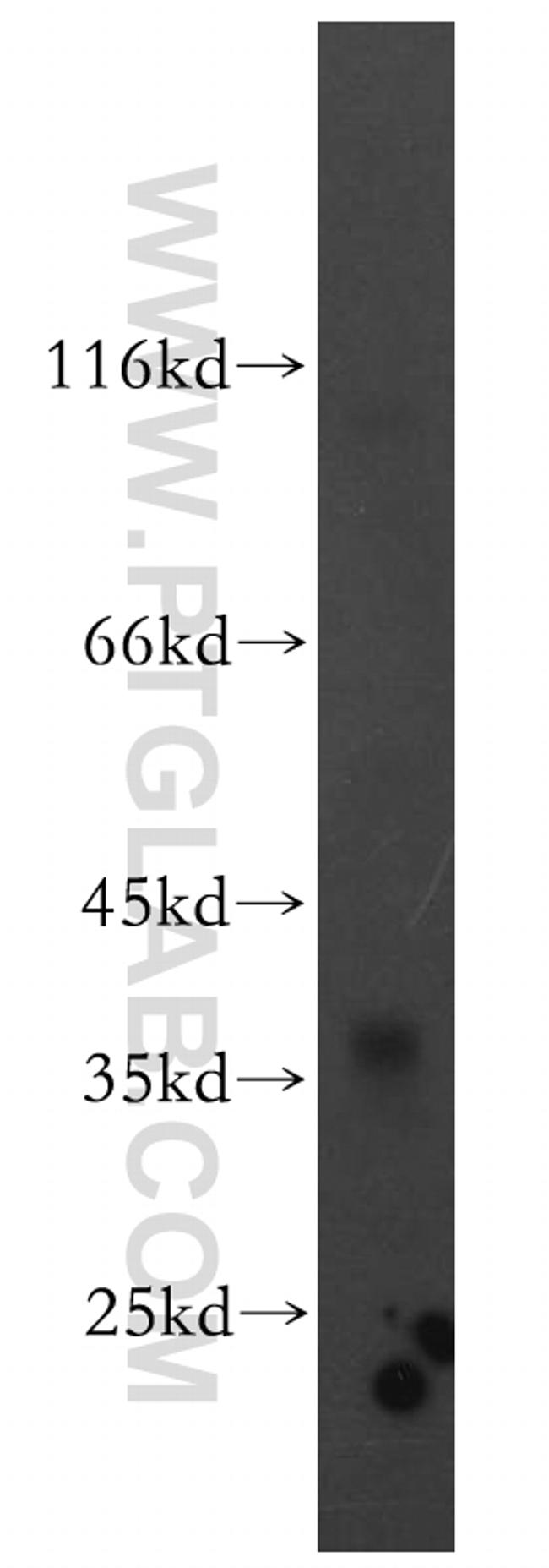 CACNG5 Antibody in Western Blot (WB)