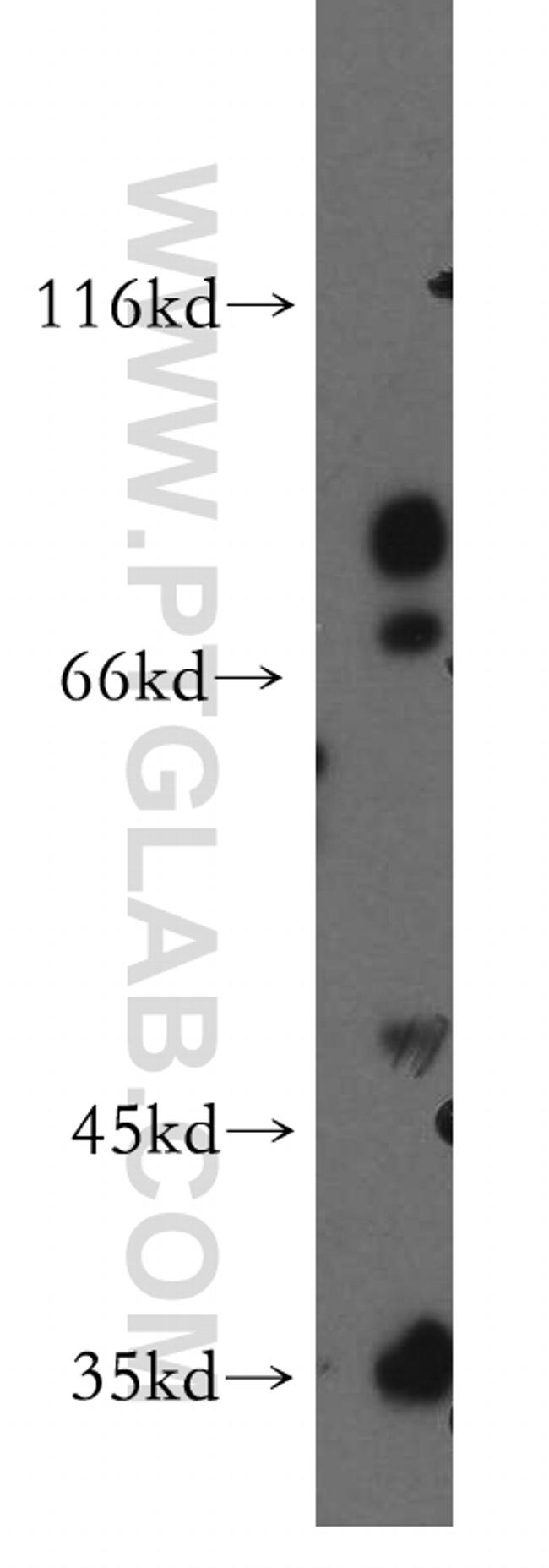 CACNG5 Antibody in Western Blot (WB)