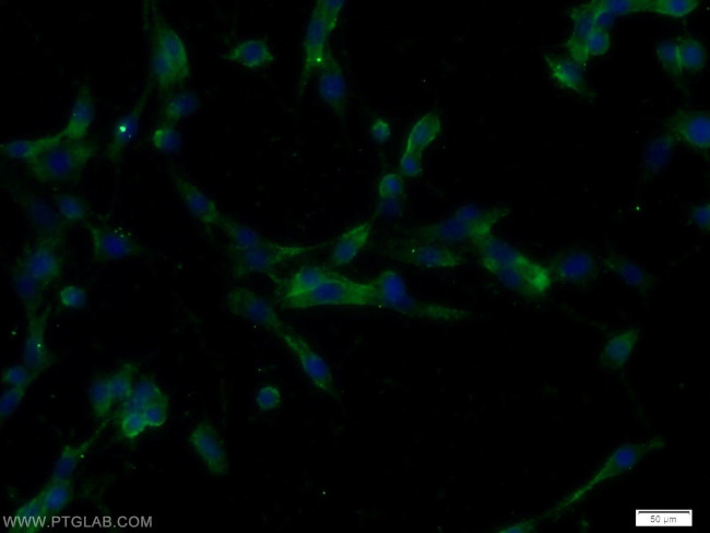 IGFBP4 Antibody in Immunocytochemistry (ICC/IF)