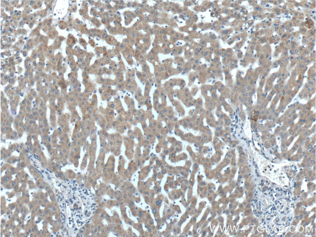 IGFBP4 Antibody in Immunohistochemistry (Paraffin) (IHC (P))