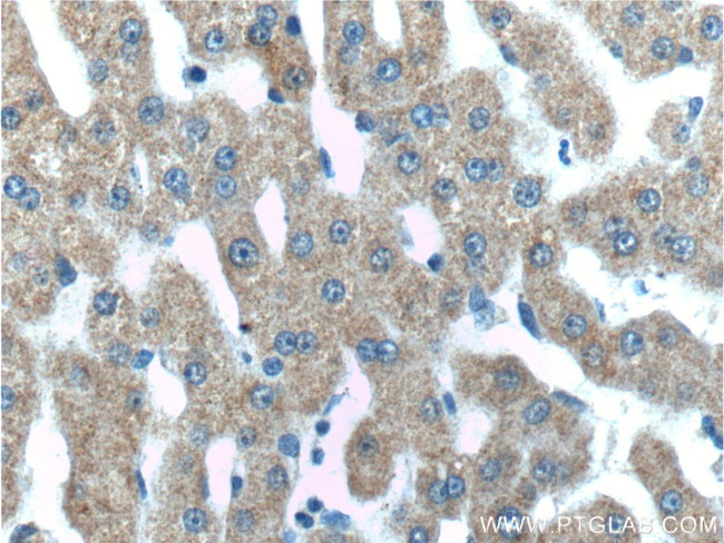 IGFBP4 Antibody in Immunohistochemistry (Paraffin) (IHC (P))