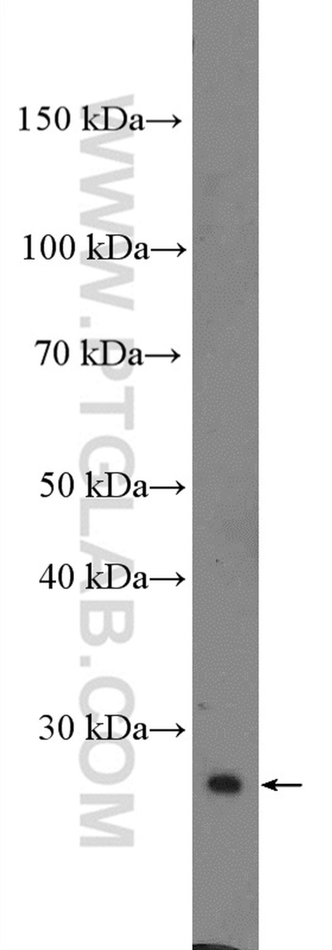 IGFBP4 Antibody in Western Blot (WB)