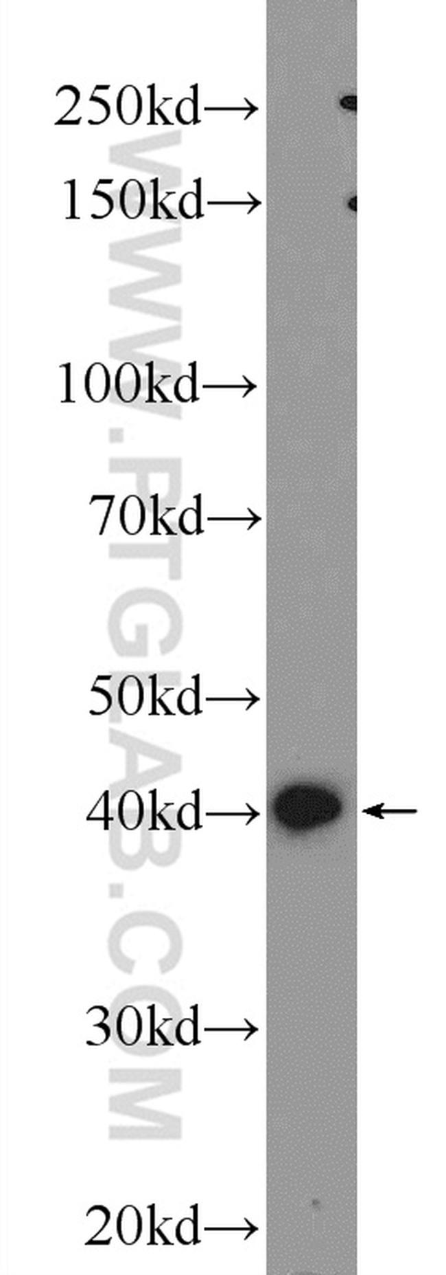 IGFBP4 Antibody in Western Blot (WB)