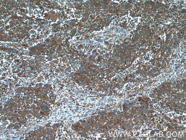 CYP1B1 Antibody in Immunohistochemistry (Paraffin) (IHC (P))