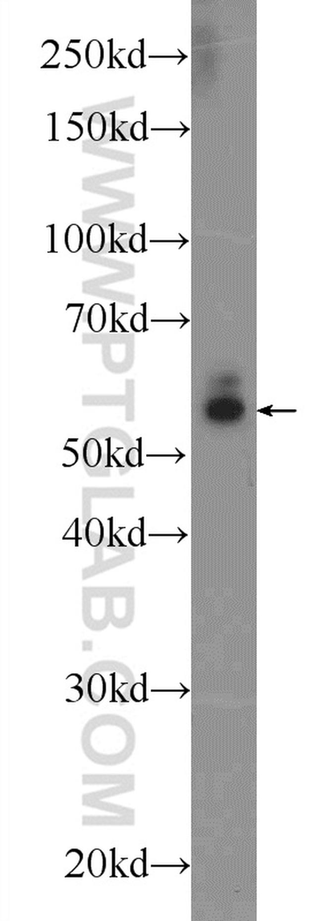 CYP1B1 Antibody in Western Blot (WB)