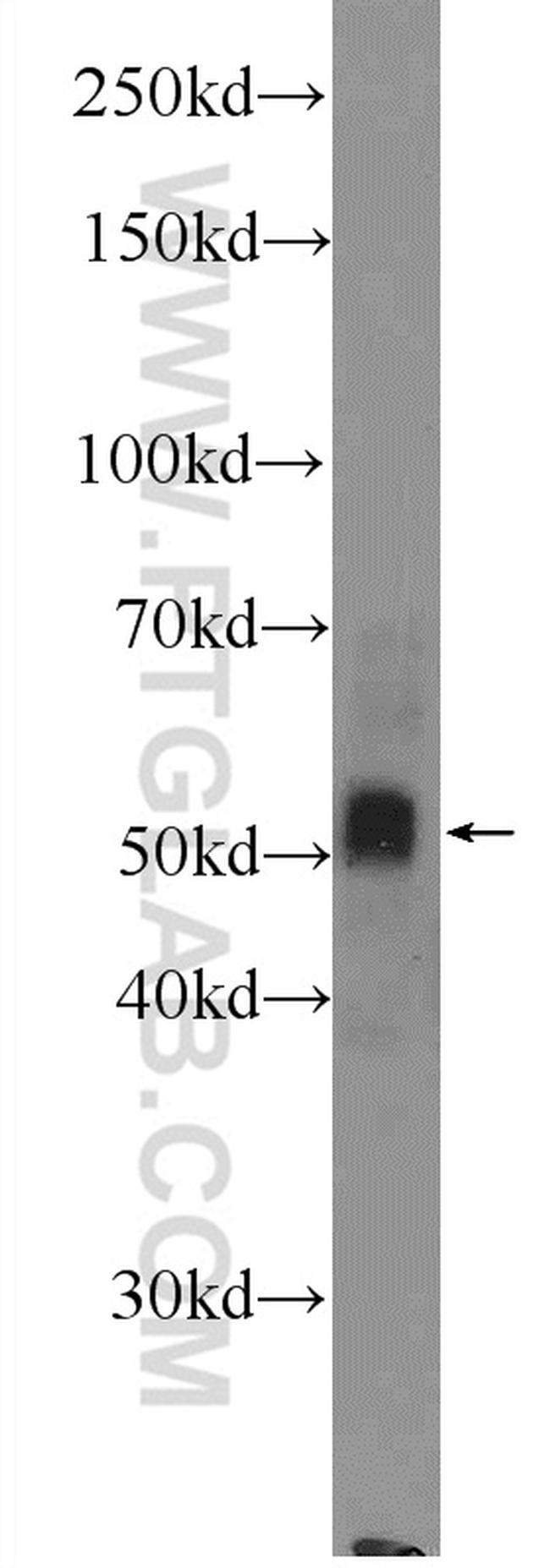 CYP1B1 Antibody in Western Blot (WB)