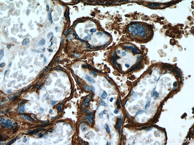 PLAP Antibody in Immunohistochemistry (Paraffin) (IHC (P))