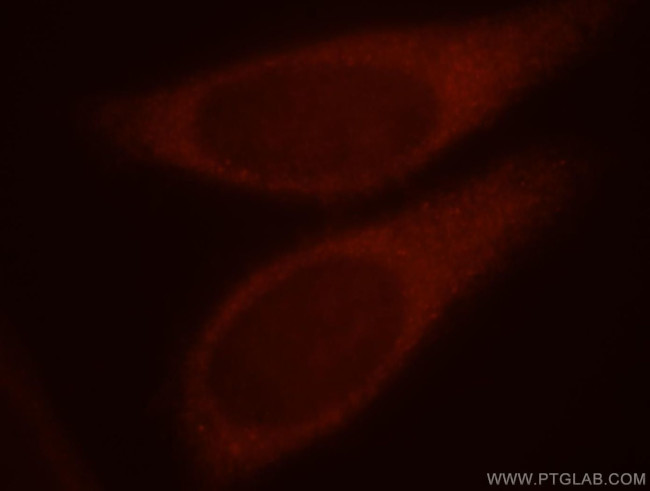 PRUNE Antibody in Immunocytochemistry (ICC/IF)