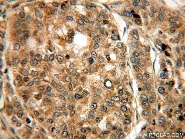 PRUNE Antibody in Immunohistochemistry (Paraffin) (IHC (P))