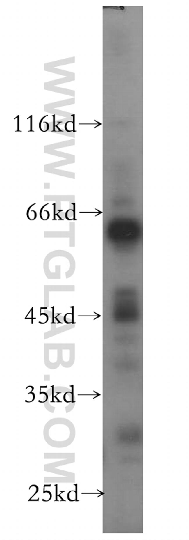 PRUNE Antibody in Western Blot (WB)