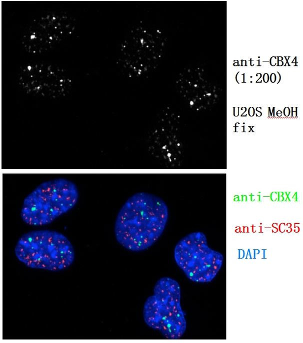 CBX4 Antibody in Immunocytochemistry (ICC/IF)