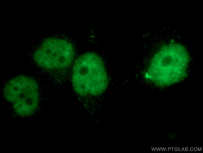 CBX4 Antibody in Immunocytochemistry (ICC/IF)