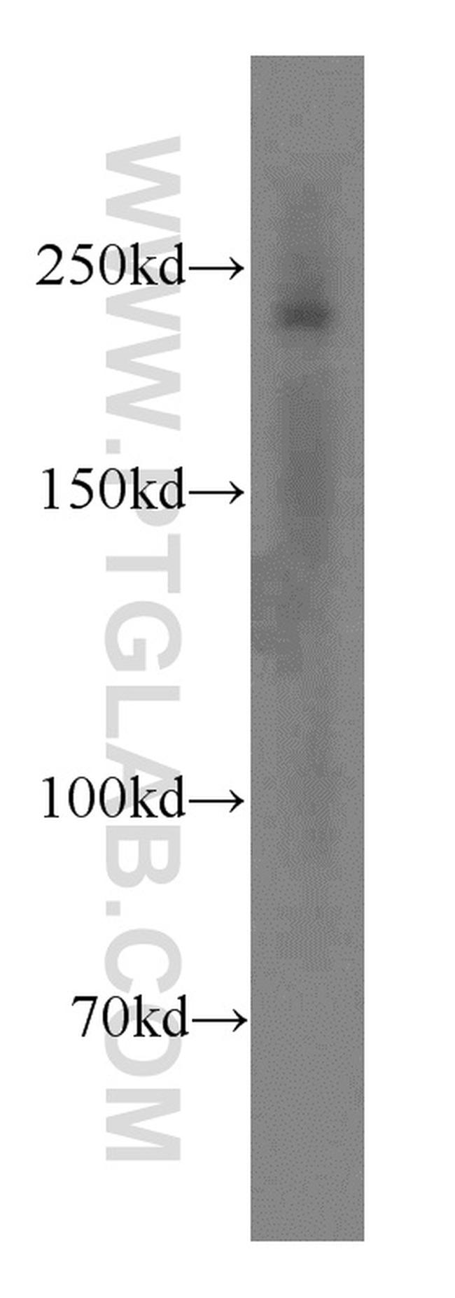 SMMHC Antibody in Western Blot (WB)