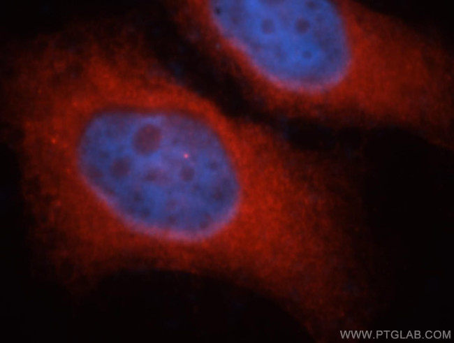 iASPP Antibody in Immunocytochemistry (ICC/IF)