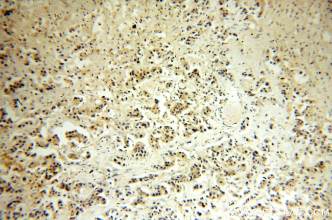 iASPP Antibody in Immunohistochemistry (Paraffin) (IHC (P))