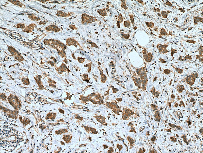 iASPP Antibody in Immunohistochemistry (Paraffin) (IHC (P))