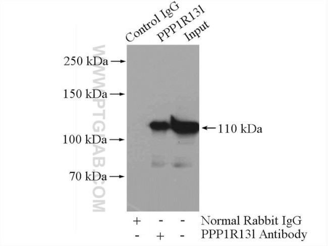 iASPP Antibody in Immunoprecipitation (IP)