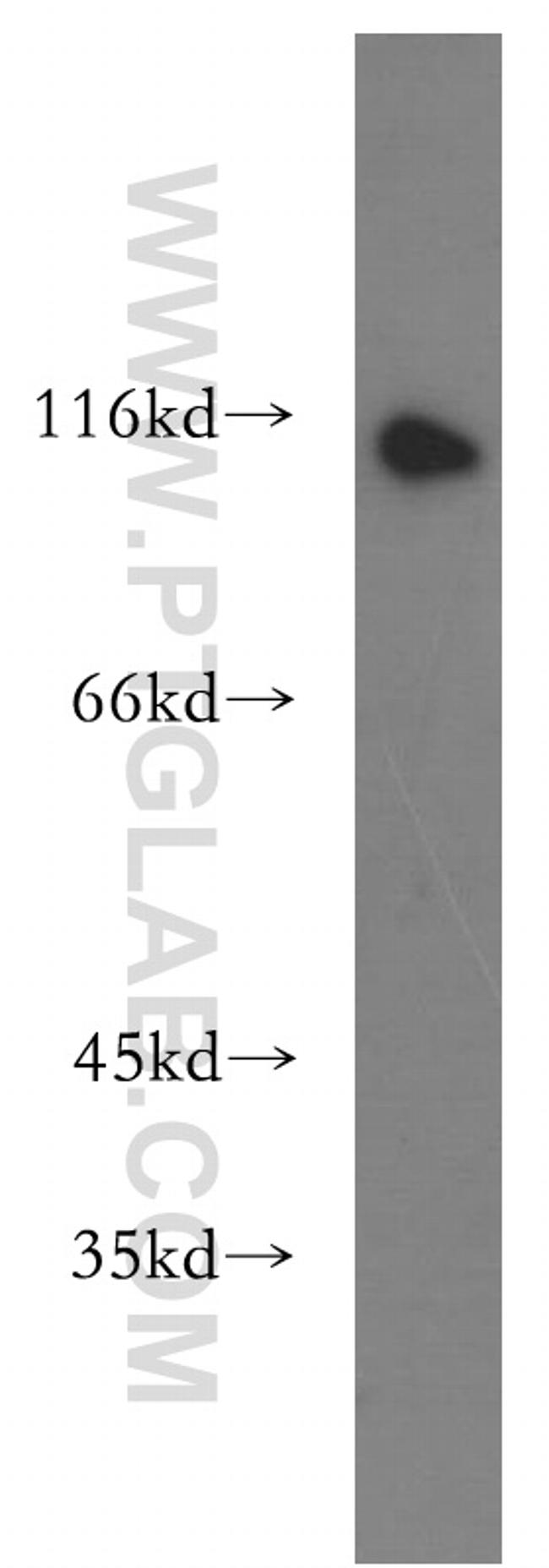 iASPP Antibody in Western Blot (WB)