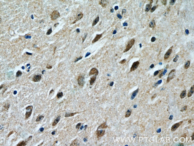 FOXO1 Antibody in Immunohistochemistry (Paraffin) (IHC (P))