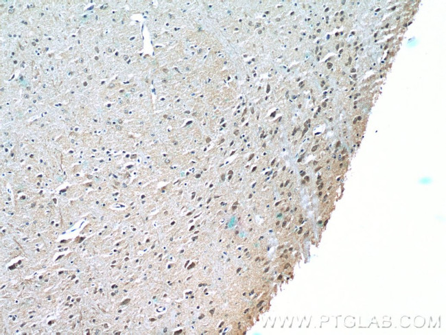 FOXO1 Antibody in Immunohistochemistry (Paraffin) (IHC (P))