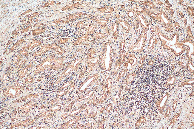 FOXO1 Antibody in Immunohistochemistry (Paraffin) (IHC (P))