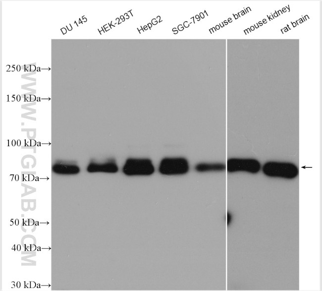 FOXO1 Antibody in Western Blot (WB)