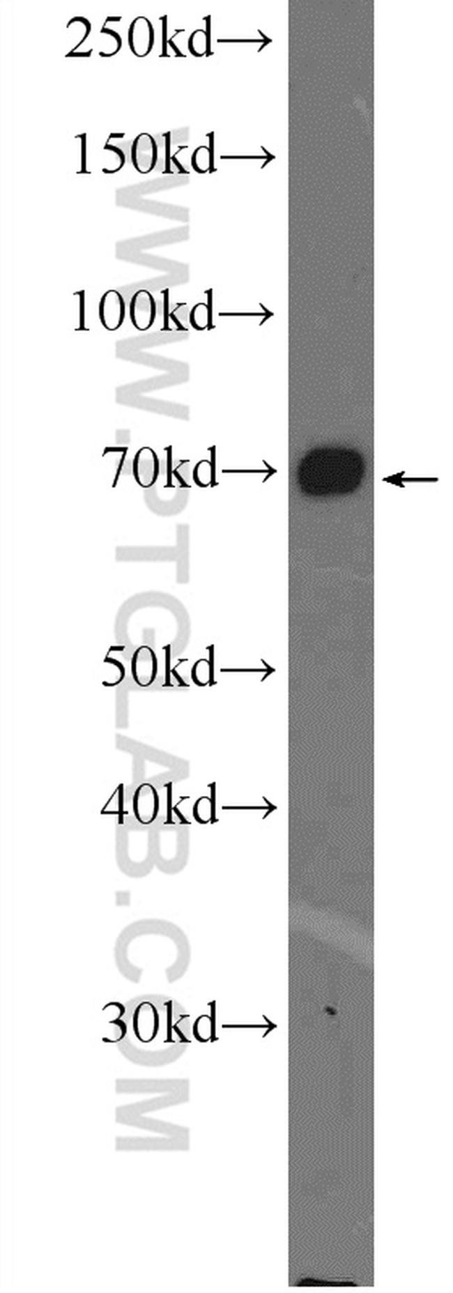 FOXO1 Antibody in Western Blot (WB)