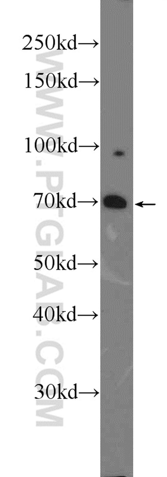 FOXO1 Antibody in Western Blot (WB)