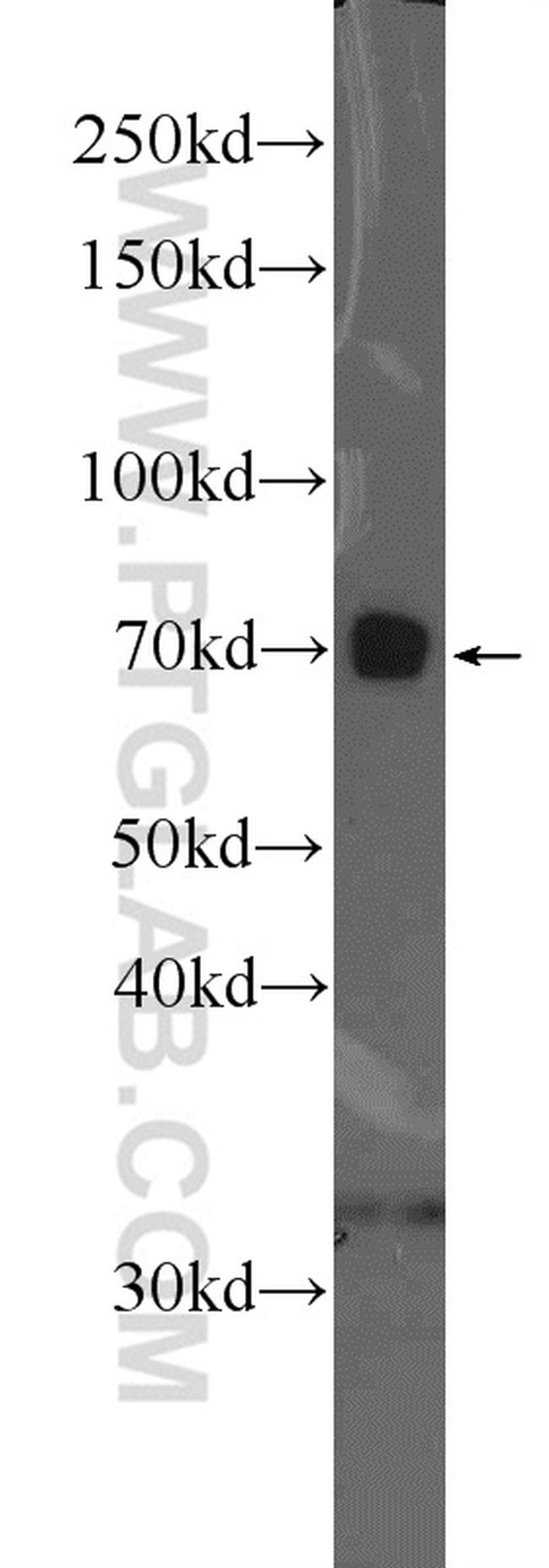 FOXO1 Antibody in Western Blot (WB)