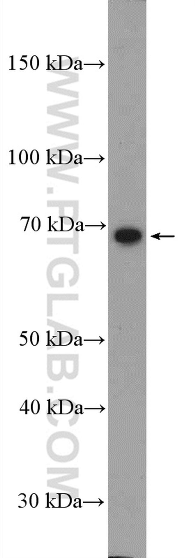 FOXO1 Antibody in Western Blot (WB)