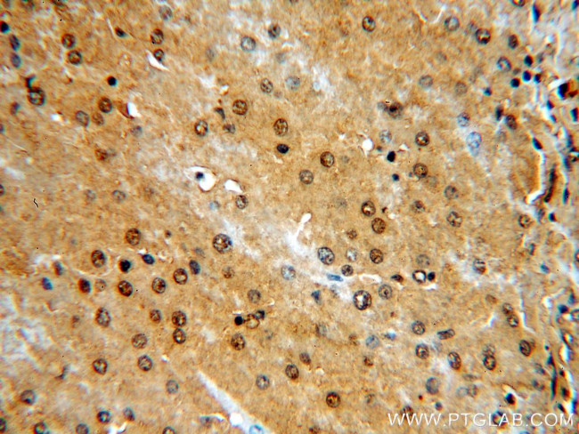 NR5A1 Antibody in Immunohistochemistry (Paraffin) (IHC (P))