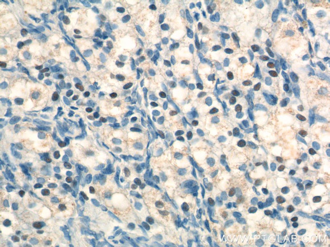 NR5A1 Antibody in Immunohistochemistry (Paraffin) (IHC (P))