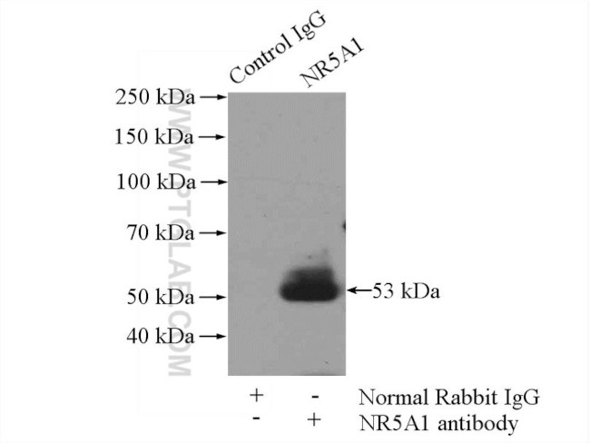 NR5A1 Antibody in Immunoprecipitation (IP)