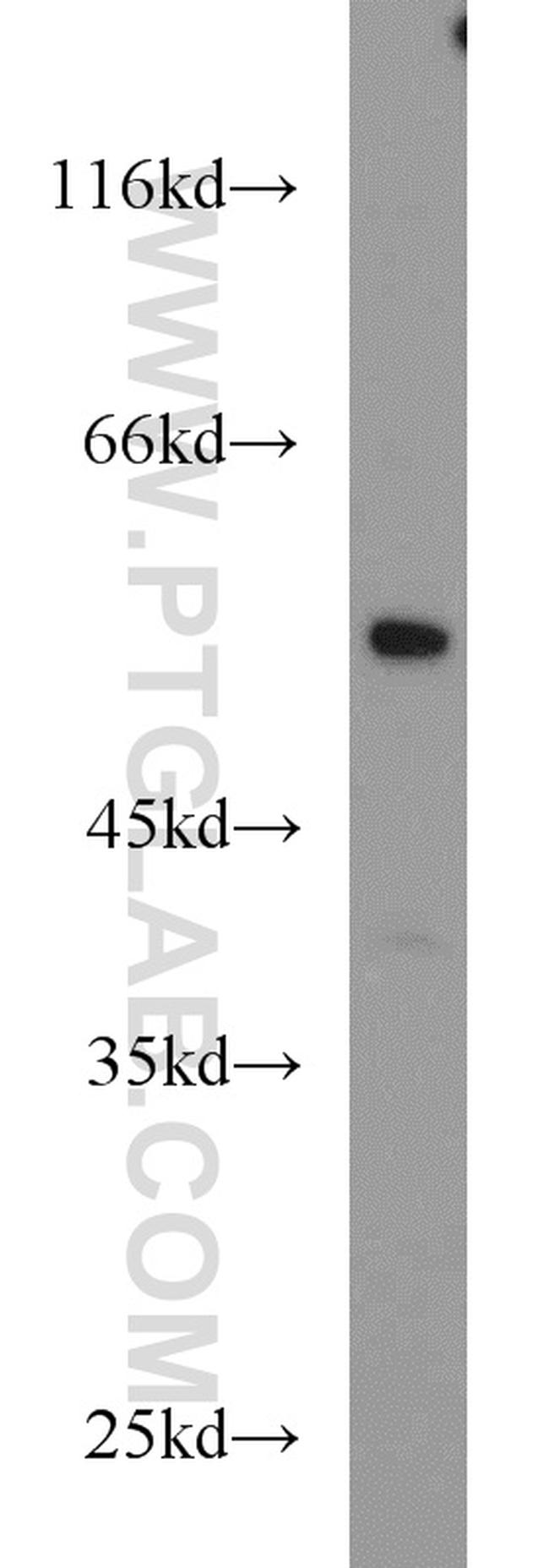 NR5A1 Antibody in Western Blot (WB)