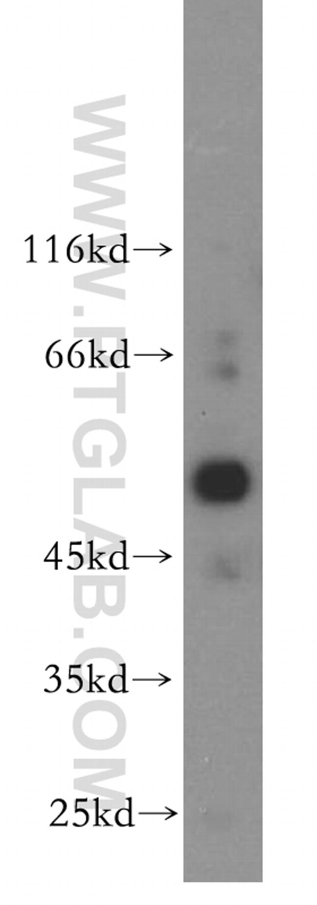 NR5A1 Antibody in Western Blot (WB)