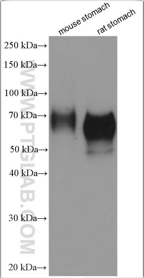 ATP4B Antibody in Western Blot (WB)