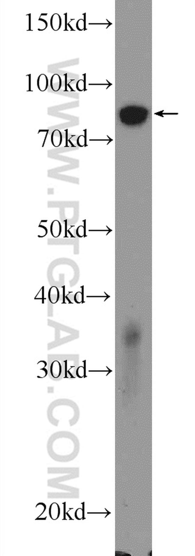 ATP4B Antibody in Western Blot (WB)