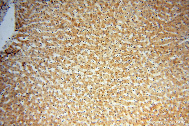 LSS Antibody in Immunohistochemistry (Paraffin) (IHC (P))