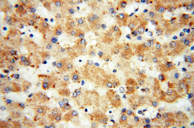 LSS Antibody in Immunohistochemistry (Paraffin) (IHC (P))