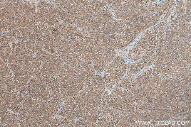 LSS Antibody in Immunohistochemistry (Paraffin) (IHC (P))