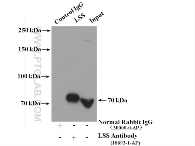 LSS Antibody in Immunoprecipitation (IP)