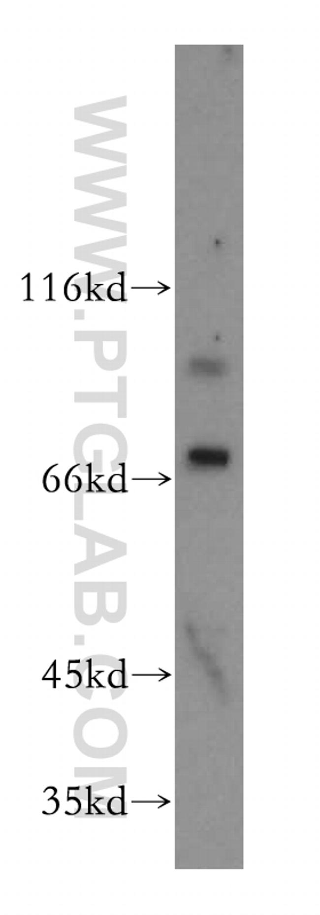 LSS Antibody in Western Blot (WB)