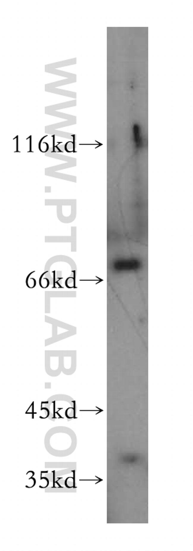 LSS Antibody in Western Blot (WB)