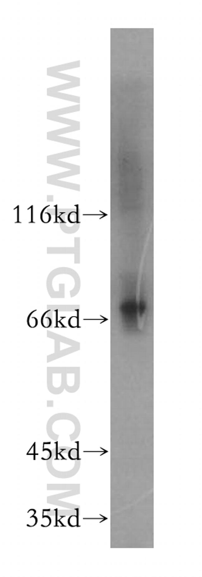 LSS Antibody in Western Blot (WB)